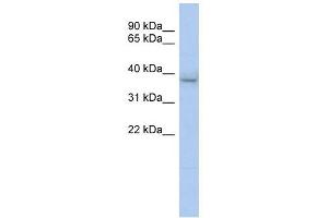 KLHDC8B antibody used at 1 ug/ml to detect target protein. (KLHDC8B antibody  (N-Term))