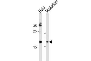 Western Blotting (WB) image for anti-Family with Sequence Similarity 159, Member A (FAM159A) antibody (ABIN3004605) (FAM159A antibody)
