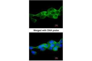 ICC/IF Image Immunofluorescence analysis of paraformaldehyde-fixed A431, using IKK beta, antibody at 1:200 dilution. (IKBKB antibody  (C-Term))