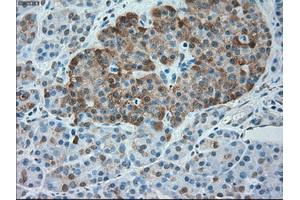 Immunohistochemical staining of paraffin-embedded Kidney tissue using anti-SERPINA1mouse monoclonal antibody. (SERPINA1 antibody)