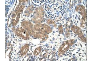 Image no. 1 for anti-Acid Phosphatase 1, Soluble (ACP1) (AA 21-70) antibody (ABIN203506) (ACP1 antibody  (AA 21-70))