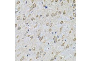 Immunohistochemistry of paraffin-embedded mouse brain using NFU1 Antibody. (NFU1 antibody  (AA 1-230))