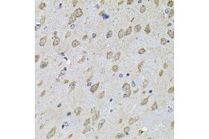 Immunohistochemistry of paraffin-embedded mouse brain using NFU1 Antibody. (NFU1 antibody  (AA 1-230))