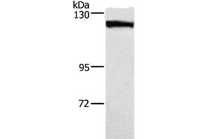 Western Blot analysis of Human tongue cancer tissue using DSG1 Polyclonal Antibody at dilution of 1:750 (Desmoglein 1 antibody)