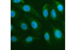 IF analysis of DDX6 using anti-DDX6 antibody (ABIN7602044). (DDX6 antibody  (AA 56-483))