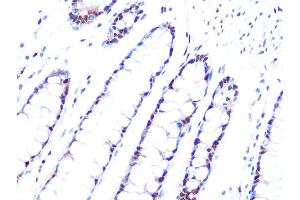 Immunohistochemistry of paraffin-embedded human colon using PRPF8 Rabbit mAb (ABIN7269737) at dilution of 1:100 (40x lens). (PRPF8 antibody)
