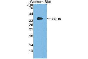 Western Blotting (WB) image for anti-Induced Myeloid Leukemia Cell Differentiation Protein Mcl-1 (MCL1) (AA 6-328) antibody (ABIN1869117) (MCL-1 antibody  (AA 6-328))