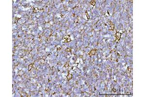 anti-RUN and FYVE Domain Containing 4 (RUFY4) (AA 1-553) antibody