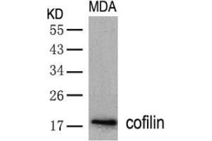 Image no. 2 for anti-Cofilin 1 (CFL1) (AA 1-5), (N-Term) antibody (ABIN197372) (Cofilin antibody  (N-Term))