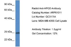 Western Blotting (WB) image for anti-Hydroxyprostaglandin Dehydrogenase 15-(NAD) (HPGD) (N-Term) antibody (ABIN786318) (HPGD antibody  (N-Term))