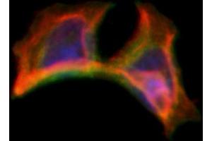 ABIN6263302 and ABIN6266595 staining Hela by IF/ICC. (Matrix Metallopeptidase 23 (MMP23) (C-Term) antibody)