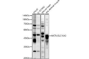 Western blot analysis of extracts of various cell lines, using MCT4/SLC16 antibody (ABIN6129472, ABIN6147859, ABIN6147860 and ABIN6214836) at 1:1000 dilution. (SLC16A3 antibody  (AA 371-465))