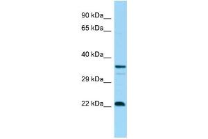 WB Suggested Anti-CD83 Antibody Titration: 1. (CD83 antibody  (C-Term))