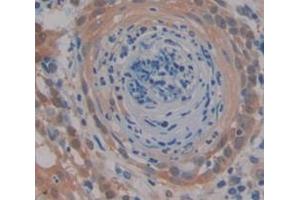 Used in DAB staining on fromalin fixed paraffin- embedded Kidney tissue (MEK2 antibody  (AA 86-331))