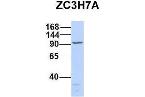 Host:  Rabbit  Target Name:  ZC3H7A  Sample Type:  721_B  Antibody Dilution:  1. (ZC3H7A antibody  (Middle Region))