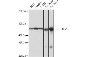 Western blot analysis of extracts of various cell lines, using UQCRC2 Rabbit mAb (ABIN1679334, ABIN3018863, ABIN3018864 and ABIN7101676) at 1:1000 dilution. (UQCRC2 antibody)