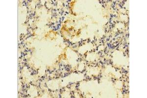 Immunohistochemistry of paraffin-embedded human lung tissue using ABIN7168904 at dilution of 1:100 (PRSS23 antibody  (AA 20-383))