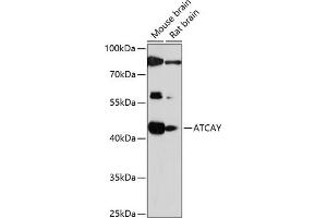Western blot analysis of extracts of various cell lines, using ATCAY antibody (ABIN7265707) at 1:1000 dilution. (ATCAY antibody  (AA 1-105))