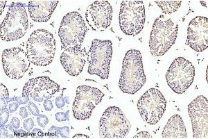 Immunohistochemical analysis of paraffin-embedded mouse testis tissue. (TUBB2A antibody)