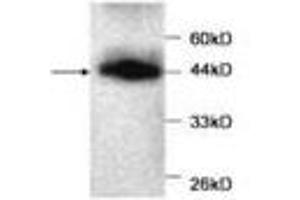 Image no. 1 for anti-Myoglobin (MB) antibody (ABIN791533) (Myoglobin antibody)