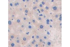 Figure. (Ceruloplasmin antibody  (AA 729-1061))