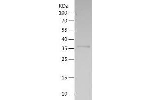 Western Blotting (WB) image for Kelch-Like ECH-Associated Protein 1 (KEAP1) (AA 378-486) protein (His-IF2DI Tag) (ABIN7282442) (KEAP1 Protein (AA 378-486) (His-IF2DI Tag))