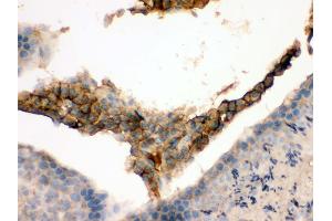 Immunohistochemistry (IHC) image for anti-Guanine Nucleotide Binding Protein (G Protein), Q Polypeptide (GNAQ) (AA 102-138), (N-Term) antibody (ABIN3043833)