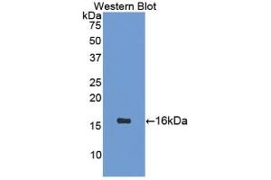 Detection of Recombinant SCT, Mouse using Polyclonal Antibody to Secretin (SCT) (Secretin antibody  (AA 26-133))