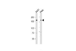 All lanes : Anti-EGFR Antibody (C-term) at 1:1000 dilution Lane 1: A431 whole cell lysate Lane 2: Hela whole cell lysate Lysates/proteins at 20 g per lane. (EGFR antibody  (C-Term))