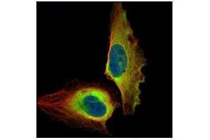 Immunofluorescence (IF) image for anti-Nuclear Factor-kB p65 (NFkBP65) (Center) antibody (ABIN2855287)