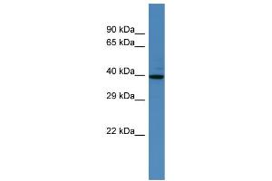 Western Blotting (WB) image for anti-Spermatogenesis Associated 2 (SPATA2) (N-Term) antibody (ABIN2774247) (SPATA2 antibody  (N-Term))