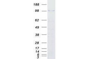 Validation with Western Blot