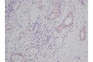 Image no. 2 for anti-KIT Ligand (KITLG) antibody (ABIN465573) (KIT Ligand antibody)
