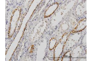 Immunoperoxidase of monoclonal antibody to PALM on formalin-fixed paraffin-embedded human kidney. (Paralemmin antibody  (AA 176-284))