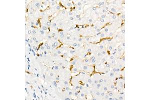 Immunohistochemistry of paraffin-embedded Human liver using Fascin/FSCN1 antibody (ABIN7267142) at dilution of 1:100 (40x lens). (Fascin antibody)