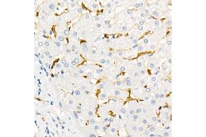 Immunohistochemistry of paraffin-embedded Human liver using Fascin/FSCN1 antibody (ABIN7267142) at dilution of 1:100 (40x lens). (Fascin antibody)