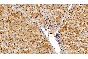 Detection of GSTa2 in Porcine Liver Tissue using Polyclonal Antibody to Glutathione S Transferase Alpha 2 (GSTa2) (GSTa2 antibody  (AA 1-222))