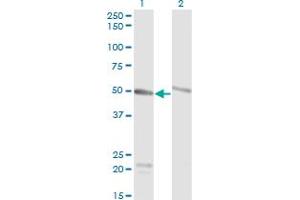 Western Blot analysis of TUBA1C expression in transfected 293T cell line by TUBA6 monoclonal antibody (M01), clone 1D2-H5. (TUBA1C antibody  (AA 1-449))