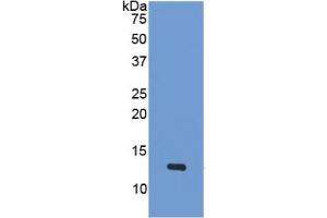 WB of Protein Standard: different control antibodies  against Highly purified E. (PF4 ELISA Kit)