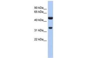 Image no. 1 for anti-Sulfotransferase Family 1B Member 1 (SULT1B1) (AA 71-120) antibody (ABIN6743489)