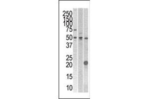 The anti- STYK1 Pab (ABIN392121 and ABIN2837982) is used in Western blot to detect STYK1 in 293 , CEM (center), and mouse kidney cell line/tissue lysates.