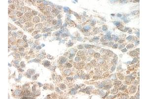 Image no. 5 for anti-Leptin (LEP) antibody (ABIN465530) (Leptin antibody)