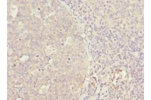 Immunohistochemistry of paraffin-embedded human tonsil tissue using ABIN7166308 at dilution of 1:100 (WNT5B antibody  (AA 120-359))