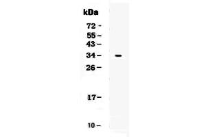 Western blot analysis of CD7 using anti-CD7 antibody . (CD7 antibody  (AA 26-172))