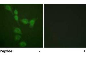Immunofluorescence analysis of A-549 cells, using PRKACA polyclonal antibody . (PRKACA antibody)
