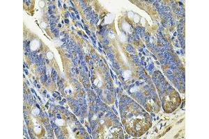 Immunohistochemistry of paraffin-embedded Mouse intestine using EIF3C Polyclonal Antibody at dilution of 1:100 (40x lens). (EIF3C antibody)
