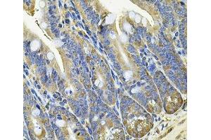 Immunohistochemistry of paraffin-embedded Mouse intestine using EIF3C Polyclonal Antibody at dilution of 1:100 (40x lens).