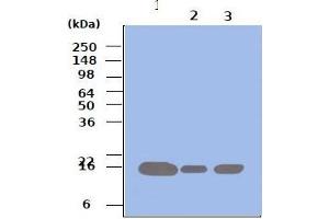 Western blot analysis: Lane 1 : 293T Lane 2 : HeLa Lane 3 : Jurkat Cell lysates of 293T, HeLa and Jurkat (each 50ug) were resolved by SDS-PAGE, transferred to PVDF membrane and probed with anti-human Pin1 (1:500). (PIN1 antibody)