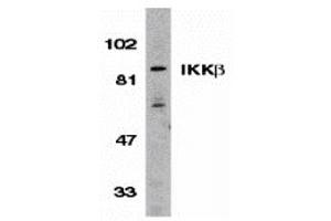 Western Blotting (WB) image for anti-Inhibitor of kappa Light Polypeptide Gene Enhancer in B-Cells, Kinase beta (IKBKB) antibody (ABIN1030209) (IKBKB antibody)