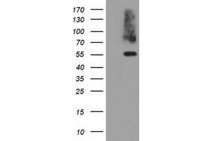 HEK293T cells were transfected with the pCMV6-ENTRY control (Left lane) or pCMV6-ENTRY PKLR (Right lane) cDNA for 48 hrs and lysed. (PKLR antibody)